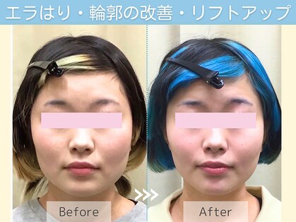 シンメトリー リラクゼルミネ横浜店の写真
