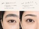 ホワイトアイ 福岡博多(WHITE EYE)の写真