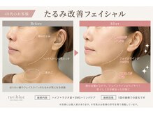 ラヴィブルー(raviblue)の雰囲気（40代から始めるたるみケア）