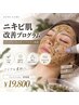 【ニキビ肌改善プログラム】ハーブピーリング×プラズマージュ殺菌