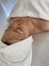 エステティック トリートメント クオリティ(Esthetic Treatments Quality)/お肌悩みに合わせた3種のハーブ