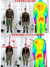 姫路なごみ整体院 なごみ鍼灸院/歪んだ姿勢