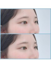 ウアココ(UAKOKO)/ラッシュリフト