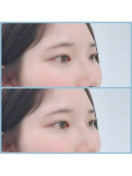 ウアココ(UAKOKO)/ラッシュリフト