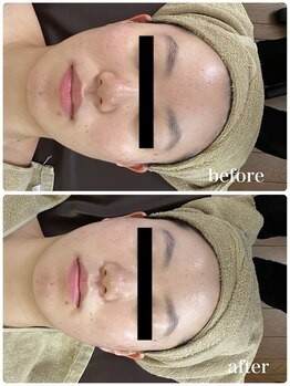 ジャスミン(Jasmin)/ホワイトニングフェイシャル