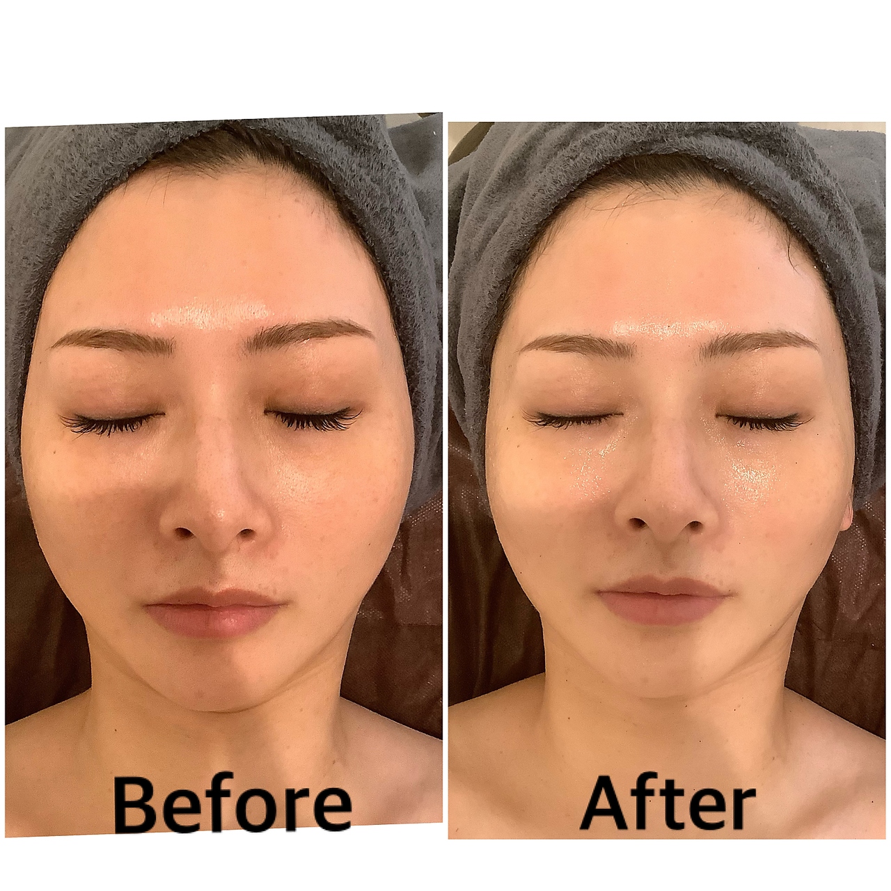 スペチアーレ 夙川/小顔と美肌が手に入る