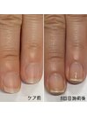 自爪育成ケア3ヶ月コース
