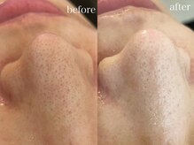 テオリア(TEORIA)/