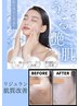 オススメ！肌質改善　リジュラン【ゴールドアンプル導入】¥13,000→