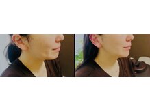サロンモコ(Salon Moco)/