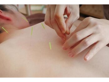 みき鍼灸マッサージの写真/首肩の重だるさをスッキリ解消！女性鍼灸師による丁寧な施術で、毎日頑張る自分に最高のご褒美時間を☆