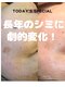 小さなおうちサロン こぐまの寝床の写真/美容通も納得！本気のシミ改善へ☆肌負担なし画期的なコース◎20個10890円