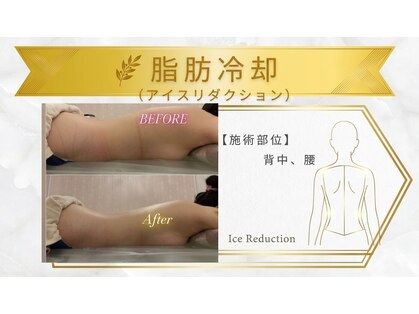エステティックサロン フェアリー(ESTHETIC SALON FAIRLY)の写真