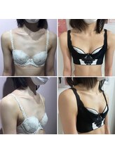 エスグレース 梅田店(S.grace)/シンデレラバストアップ施術