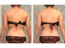 サロンドプレマージュ(Salon de Premage)/ソフト矯正リンパケア、ラフォス