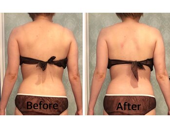 サロンドプレマージュ(Salon de Premage)/ソフト矯正リンパケア、ラフォス