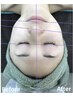 【様々なトラブルに対応】光フェイシャル　￥5,500