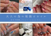 ヴィリンクプラス(Vi-Link+)