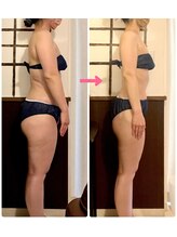 リアン(Liens)/Liens痩身は姿勢改善もケア◎