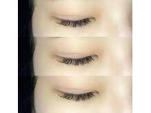 アーラ(ala)/volume×2