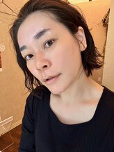 ドルチェエフェクト(dolce effect)/韓国式肌管理プログラム