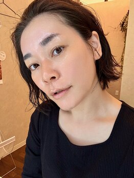 ドルチェエフェクト(dolce effect)/韓国式肌管理プログラム