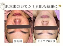 シフォン(Chiffon)の雰囲気（特殊なペンでしみの気になる部分をなぞり、優しくアプローチ。）