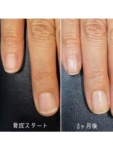 ネイルズ アヴァンティ(Nails Avanti)/自爪育成ケア3ヶ月コース