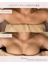 エレンシア(E'lencia)/施術効果（Before/After）