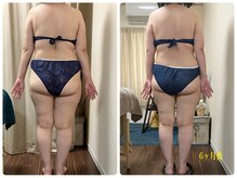 グラン ジュテの雰囲気（リポベラ開始！レッドショット×LDM・ラジオ波で痩身・美bodyへ）