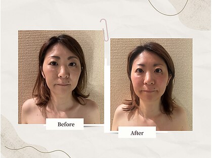 アユナタ(Ayu Natah)の写真