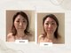 アユナタ(Ayu Natah)の写真
