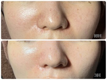 ボディメイクサロン リリー(Body make salon Lily)/