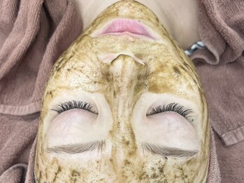 コーラル(coral)の写真/繰り返す肌荒れを解消し,肌質を根本改善◎毛穴ケア+マッサージでリフトアップ効果も☆自信の持てる素肌へ♪