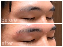 クラシックス(CLASSICS)/美眉ワックス脱毛