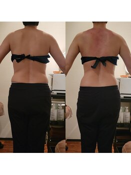 サロン ソワイユ(salon soyeux)/ダイエットに自信あり♪