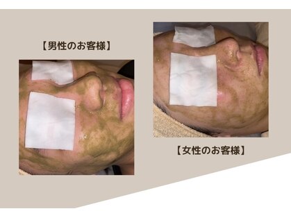 ワンビ(One be.)の写真