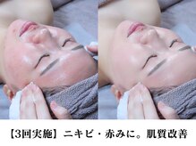 オクタボー 南青山(OCTAVO)