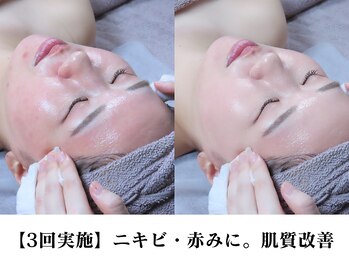 オクタボー 南青山(OCTAVO)