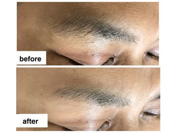 アップル マリー 江別/■糸脱毛（似合わせ眉毛脱毛）