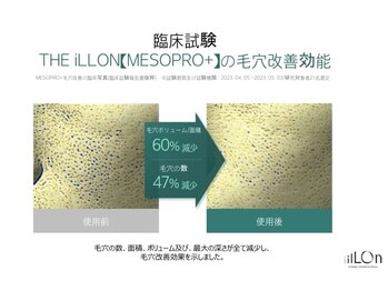 アルメ(Alume)/毛穴悩みにおすすめ