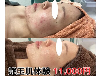 エデン(Eden)の写真/最先端韓国艶玉美肌プログラムで憧れの艶肌に！最短２ヶ月で見違え肌に激変◎