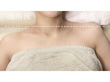 トータルビューティーサロン カノン(Kanon)の雰囲気（アーユルヴェーダ導入◇一度の施術で効果を実感される方多数！）