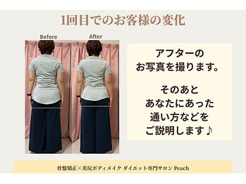 ピーチ(Peach)/アフターの撮影