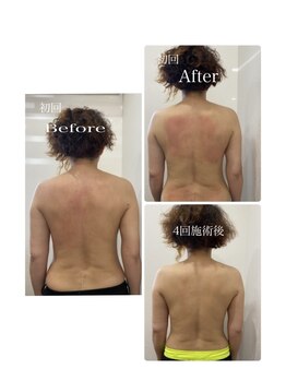 マーガレット整体/DDS微弱電流のビフォーアフター