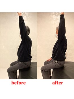 ナオル整体 福岡香椎院(NAORU整体)/50代男性施術事例【左肩の痛み】