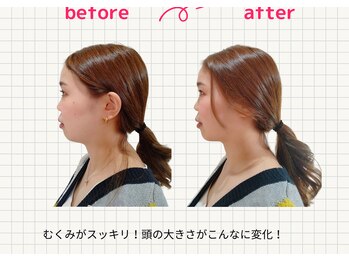 ナチュラルハリー(NaturalHarry)/当サロン自慢の経絡小顔施術!