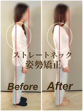 ティーエスエル とがし整体ラボ(TSL とがし整体 Labo)/姿勢矯正・猫背 巻き肩/美容整体