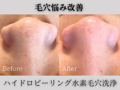 クリオ(Crio)の写真
