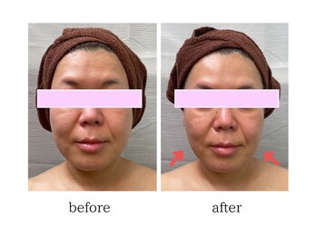 レディア(Re:Dear)/